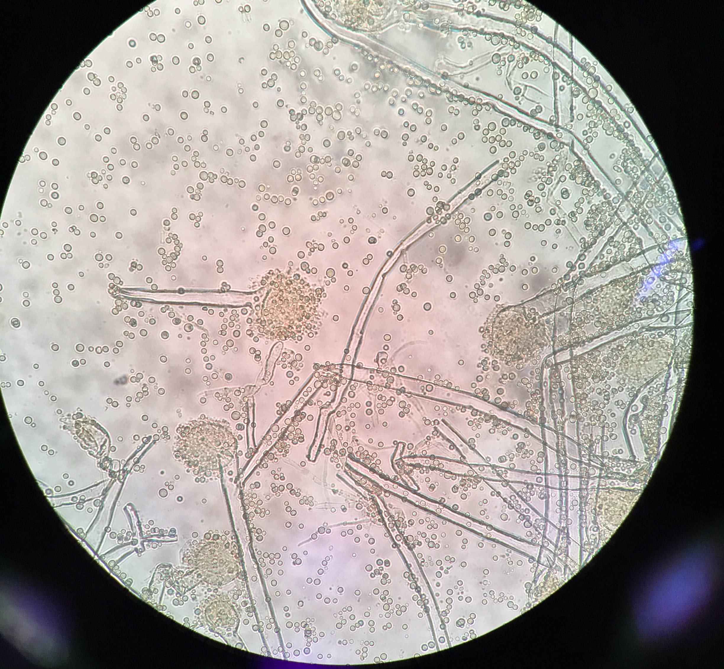 aspergillus-flavus