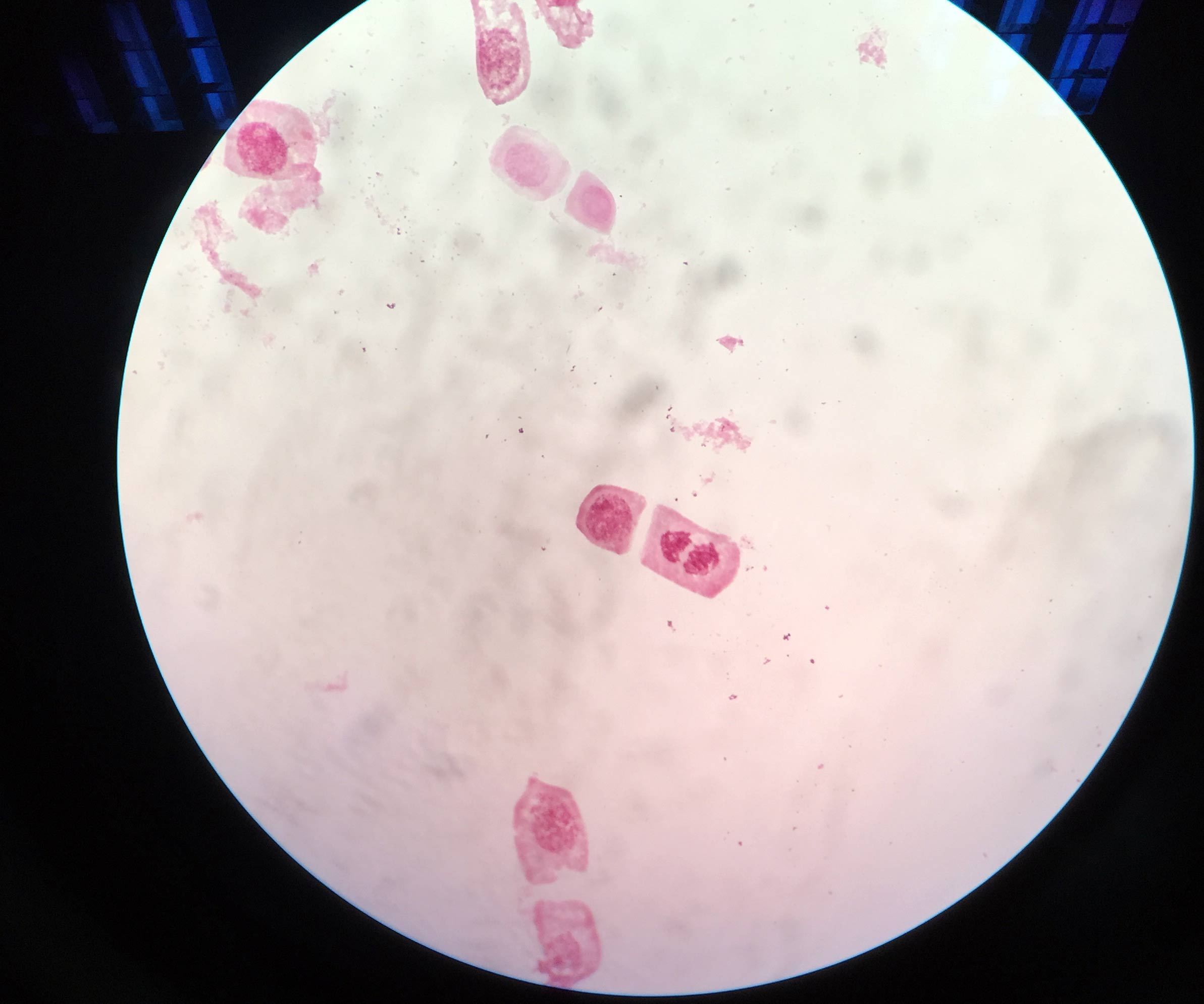 hucre-ve-kromozomlar