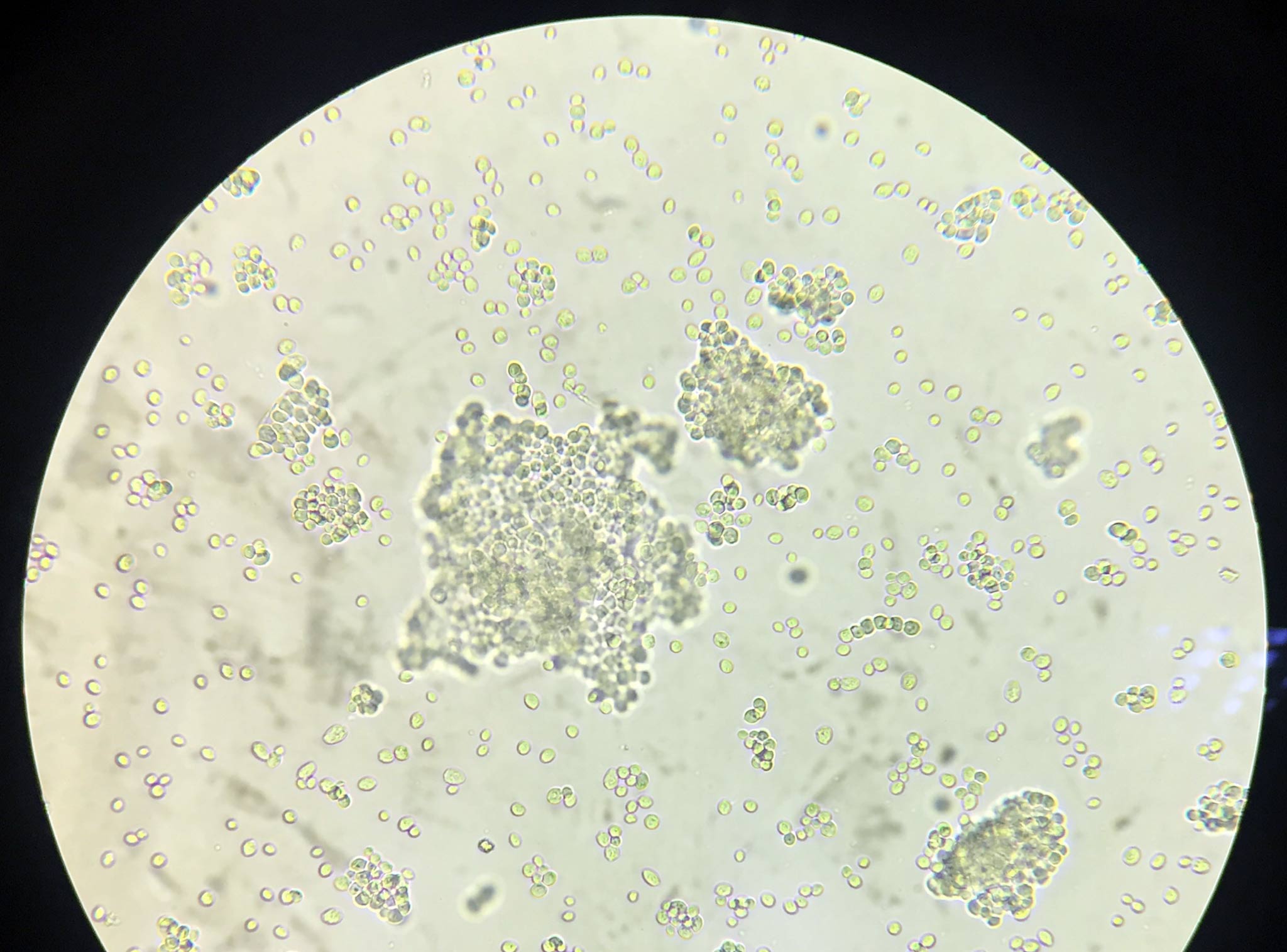 Saccharomyces Cerevisiae