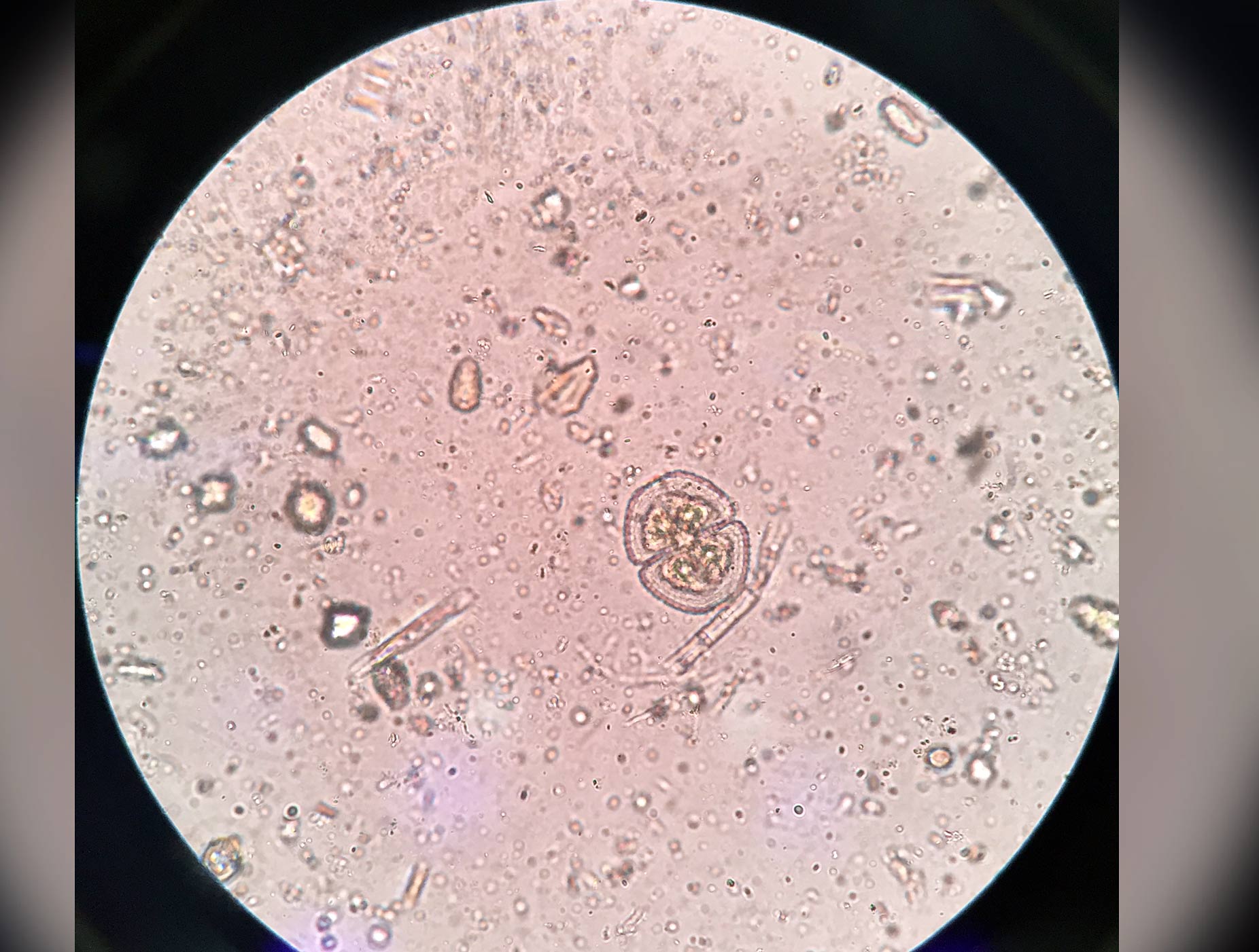 saccharomyces-cerevisiae
